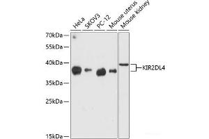 Western blot analysis of extracts of various cell lines using KIR2DL4 Polyclonal Antibody at dilution of 1:3000.