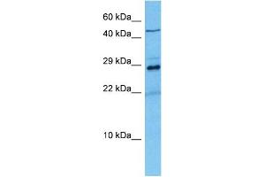 Host:  Mouse  Target Name:  KCNIP2  Sample Tissue:  Mouse Liver  Antibody Dilution:  1ug/ml (KCNIP2 anticorps  (N-Term))