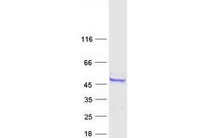 Validation with Western Blot
