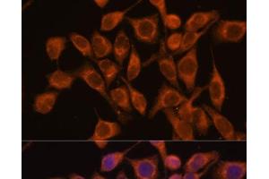 Immunofluorescence analysis of HeLa cells using UBQLNL Polyclonal Antibody at dilution of 1:100. (UBQLNL anticorps)