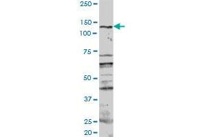 PKN1 MaxPab rabbit polyclonal antibody. (PKN1 anticorps  (AA 1-942))