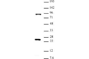 Suz12 antibody (pAb) tested by Western blot. (SUZ12 anticorps  (C-Term))