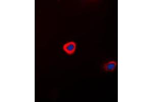 Immunofluorescent analysis of Connexin 43 staining in HeLa cells. (Connexin 43/GJA1 anticorps  (C-Term))