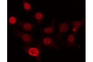 ABIN6266946 staining HepG2 by IF/ICC. (CDKL4 anticorps  (Internal Region))