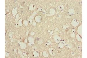 Immunohistochemistry of paraffin-embedded human brain tissue using ABIN7157257 at dilution of 1:100 (KBTBD7 anticorps  (AA 475-684))
