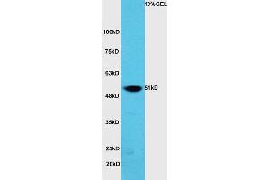 Lane 1:A549 cell lysates probed with Rabbit Anti-hnRNP K Polyclonal Antibody, Unconjugated (ABIN706571) at 1:300 overnight at 4 °C. (HNRNPK anticorps  (AA 201-300))
