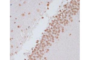 Immunohistochemistry of paraffin-embedded Rat brain using Phospho-Stat3(Y705) Polyclonal Antibody at dilution of 1:100 (40x lens). (STAT3 anticorps  (pTyr705))