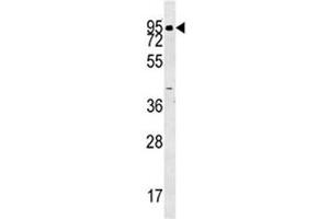 ABP1 antibody western blot analysis in human K562 lysate. (DAO anticorps  (AA 71-100))