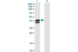 Western Blotting (WB) image for anti-Pyruvate Dehydrogenase beta (PDHB) (AA 250-360) antibody (ABIN598861) (PDHB anticorps  (AA 250-360))