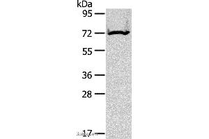 Western blot analysis of Mouse kidney tissue, using CPT2 Polyclonal Antibody at dilution of 1:200 (CPT2 anticorps)