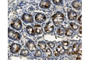 IHC analysis of ME2 using anti-ME2 antibody (ABIN7600967). (NAD-ME anticorps  (AA 26-584))