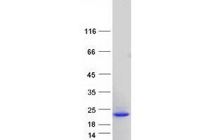 Validation with Western Blot