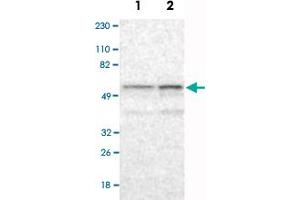 Western Blot analysis of Lane 1: RT-4 and Lane 2: U-251MG sp cell lysates with RBM23 polyclonal antibody . (RBM23 anticorps)