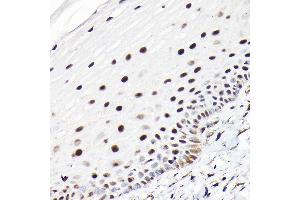Immunohistochemistry of paraffin-embedded human normal cervix using CTCF Rabbit pAb (ABIN6130043, ABIN6139180, ABIN6139182 and ABIN6217207) at dilution of 1:100 (40x lens). (CTCF anticorps  (AA 1-260))