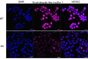 Immunocytochemical staining of HeLa cells using Small ubiquitin like modifier 1 antibody (ABIN7800382), 1:1,000), Top panel: wild-type (WT), Bottom panal: Small ubiquitin like modifier 1 shRNA knockdown (KD).