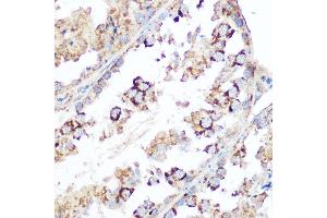 Immunohistochemistry of paraffin-embedded mouse testis using Smac/Diablo Rabbit pAb (ABIN3023378, ABIN3023379, ABIN3023380 and ABIN6219667) at dilution of 1:100 (40x lens). (DIABLO anticorps  (AA 1-232))