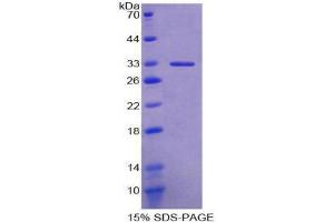 SDS-PAGE (SDS) image for Ectonucleoside Triphosphate diphosphohydrolase 1 (ENTPD1) (AA 241-486) protein (His tag) (ABIN2124691)