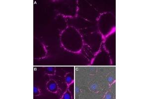 Expression of P2RX7 in rat brain glioma (C6) cells - Cell surface detection of P2RX7 in intact living rat C6 cells. (P2RX7 anticorps  (Extracellular Loop) (Atto 633))
