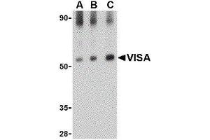 Western Blotting (WB) image for anti-Mitochondrial Antiviral Signaling Protein (MAVS) antibody (ABIN2477103) (MAVS anticorps)