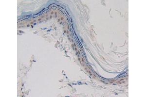 Used in DAB staining on fromalin fixed paraffin- embedded skin tissue