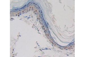 Used in DAB staining on fromalin fixed paraffin- embedded skin tissue (CASP14 anticorps  (AA 1-246))
