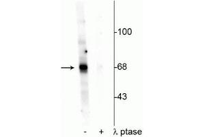 Western blot of Drosophila lysate showing specific labeling of the ~68 kDa AKT protein phosphorylated at Thr342 in the first lane (-). (AKT1 anticorps  (pThr342))