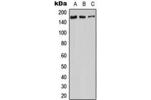 Western blot analysis of Adenylate Cyclase 9 expression in HeLa (A), SP2/0 (B), H9C2 (C) whole cell lysates.