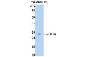 Detection of Recombinant SIRT4, Rat using Polyclonal Antibody to Sirtuin 4 (SIRT4) (SIRT4 anticorps  (AA 60-255))