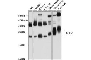 Western blot analysis of extracts of various cell lines, using CRIP2 Antibody (ABIN6130132, ABIN6139042, ABIN6139043 and ABIN6224870) at 1:1000 dilution. (CRIP2 anticorps  (AA 1-208))