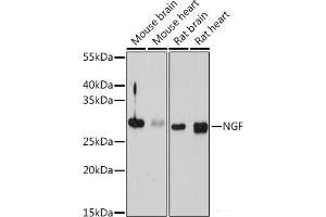 Western blot analysis of extracts of various cell lines using NGF Polyclonal Antibody at dilution of 1:1000. (Nerve Growth Factor anticorps)