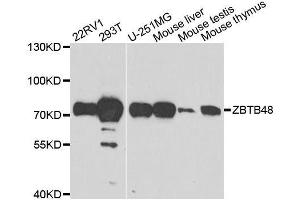 Western blot analysis of extracts of various cell lines, using ZBTB48 antibody. (ZBTB48 anticorps  (AA 1-280))