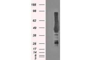 Western Blotting (WB) image for anti-Carbonic Anhydrase IX (CA9) antibody (ABIN1497095) (CA9 anticorps)