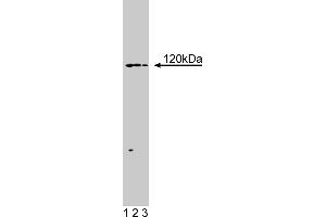 Western Blotting (WB) image for anti-Huntingtin Interacting Protein 1 Related (HIP1R) (AA 560-772) antibody (ABIN968746) (HIP1R anticorps  (AA 560-772))