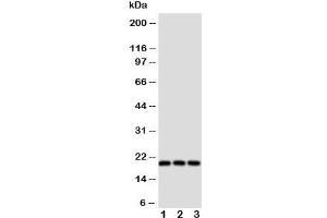 Western blot testing of Thy1 antibody and Lane 1:  rat brain;  2: rat liver;  3: rat thymus tissue lysate