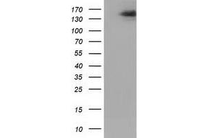 Western Blotting (WB) image for anti-L1 Cell Adhesion Molecule (L1CAM) antibody (ABIN1499087) (L1CAM anticorps)