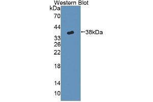 Detection of Recombinant CYP17A1, Mouse using Polyclonal Antibody to Cytochrome P450 17A1 (CYP17A1)
