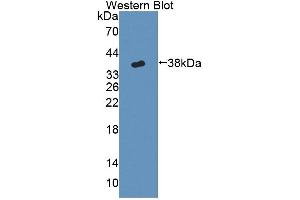 Detection of Recombinant CYP17A1, Mouse using Polyclonal Antibody to Cytochrome P450 17A1 (CYP17A1) (CYP17A1 anticorps  (AA 201-507))