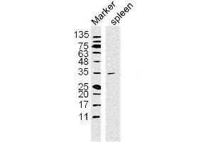 Lane 1: Mouse Spleen lysates probed with NFKBIA/IKB alpha Polyclonal Antibody, Unconjugated  at 1:300 overnight at 4˚C.