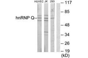 Western blot analysis of extracts from Jurkat/HuvEc/293 cells, using hnRNP Q Antibody. (SYNCRIP anticorps  (AA 236-285))