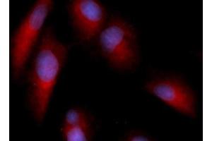 Immunofluorescence (IF) image for anti-Annexin A5 (ANXA5) (AA 1-320) antibody (PE) (ABIN5564838)