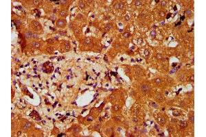 IHC image of ABIN7164887 diluted at 1:200 and staining in paraffin-embedded human liver tissue performed on a Leica BondTM system. (PTOV1 anticorps  (AA 2-137))