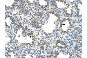 SLC26A5 antibody was used for immunohistochemistry at a concentration of 4-8 ug/ml. (SLC26A5 anticorps)