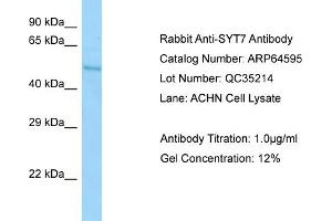 Western Blotting (WB) image for anti-Synaptotagmin VII (SYT7) (C-Term) antibody (ABIN2789889) (SYT7 anticorps  (C-Term))