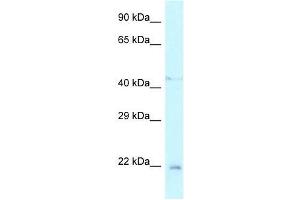 Western Blot showing Twist1 antibody used at a concentration of 1. (TWIST1 anticorps  (N-Term))