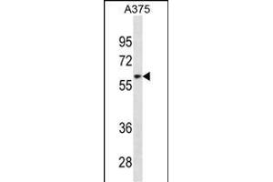 ZNF394 anticorps  (AA 287-316)