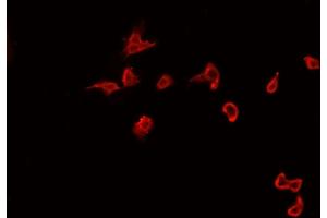 ABIN6267071 staining A-431 cells by IF/ICC.