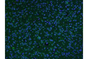 Paraformaldehyde-fixed, paraffin embedded Mouse brain Antigen retrieval by boiling in sodium citrate buffer (pH6. (AKAP12 anticorps  (AA 701-900))
