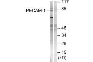 Western blot analysis of extracts from Jurkat cells, using PECAM-1 (Ab-713) antibody.
