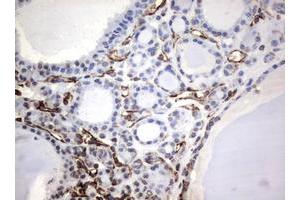 Image no. 8 for anti-Vimentin (VIM) (AA 210-466) antibody (ABIN1491200)