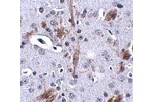 Immunohistochemistry of TTBK1 in mouse brain tissue with this product at 2. (TTBK1 anticorps  (C-Term))
